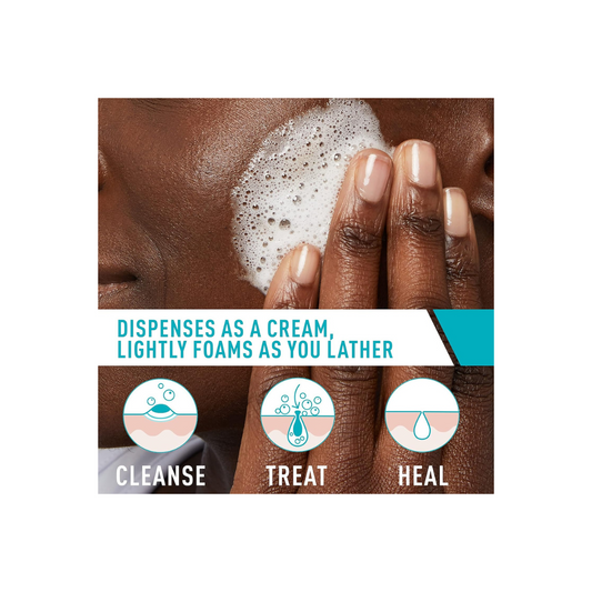 CeraVe Acne Foaming Cream Wash Gentle Face and Body Acne Cleanser with Benzoyl Peroxide 10%, Hyaluronic Acid #ClearSkinJourney #AcneFighter #GentleCleanser #BenzoylPeroxide #AcneCare #HydrationBoost #FaceAndBody #DermatologistRecommended #BreakoutControl #HealthySkinRoutine